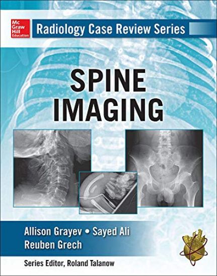 Radiology Case Review Series: Spine