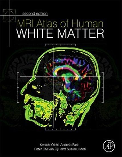 MRI Atlas of Human White Matter