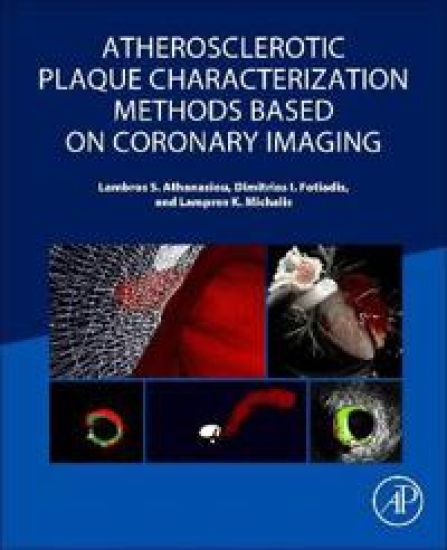 Atherosclerotic Plaque Characterization Methods Based on Coronary Imaging