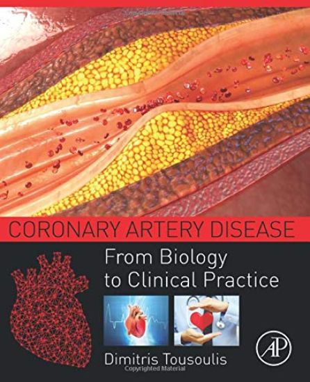 Coronary Artery Disease