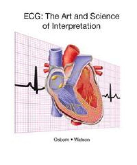 ECG Interpretation