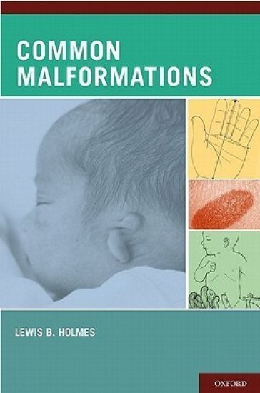 Common Malformations