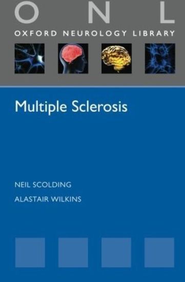Multiple Sclerosis