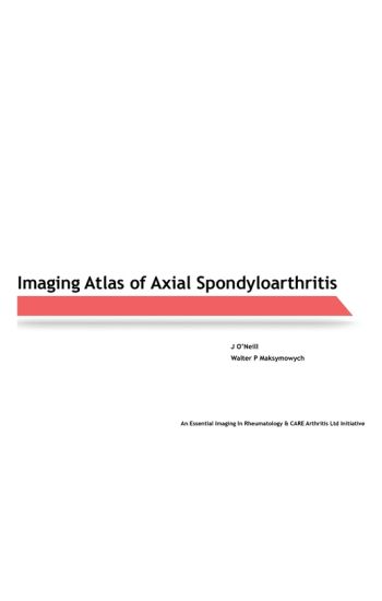 Imaging Atlas of Axial Spondyloarthritis
