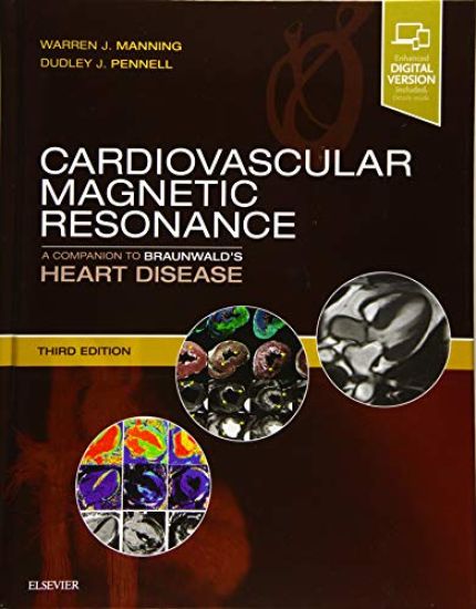 Cardiovascular Magnetic Resonance