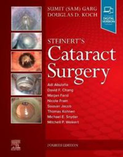 Steinert's Cataract Surgery