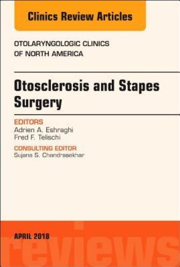 Otosclerosis and Stapes Surgery, An Issue of Otolaryngologic Clinics of North America