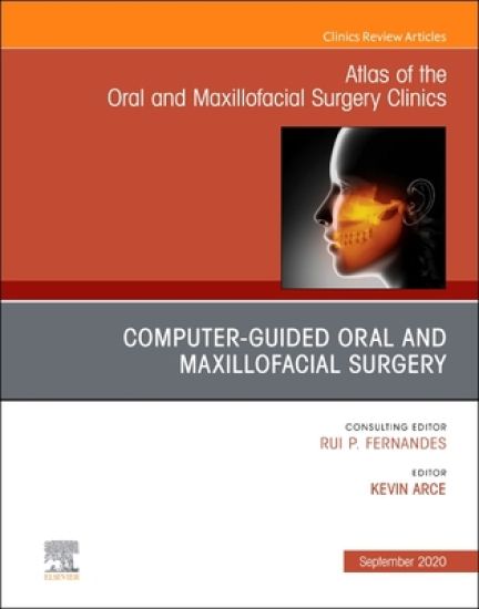 Guided Oral and Maxillofacial Surgery An Issue of Atlas of the Oral & Maxillofacial Surgery Clinics