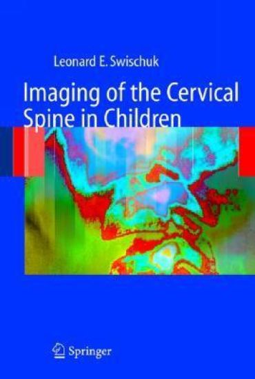 Imaging of the Cervical Spine in Children