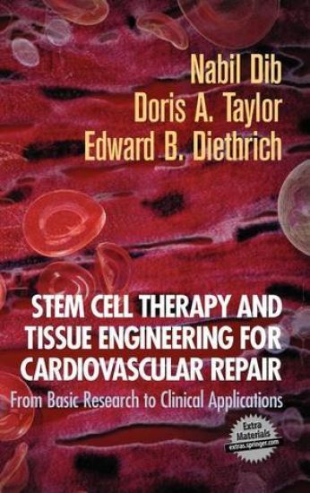 Stem Cell Therapy and Tissue Engineering for Cardiovascular Repair