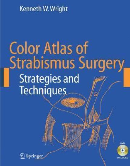 Color Atlas of Strabismus Surgery