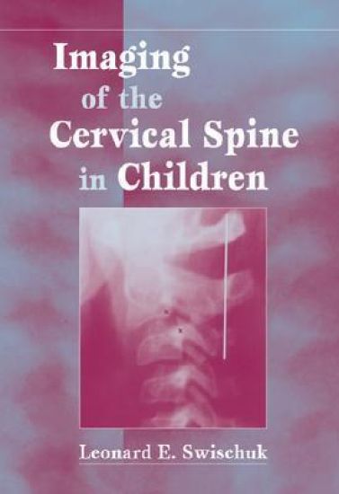 Imaging of the Cervical Spine in Children