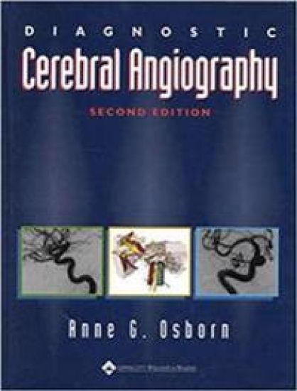 Diagnostic Cerebral Angiography