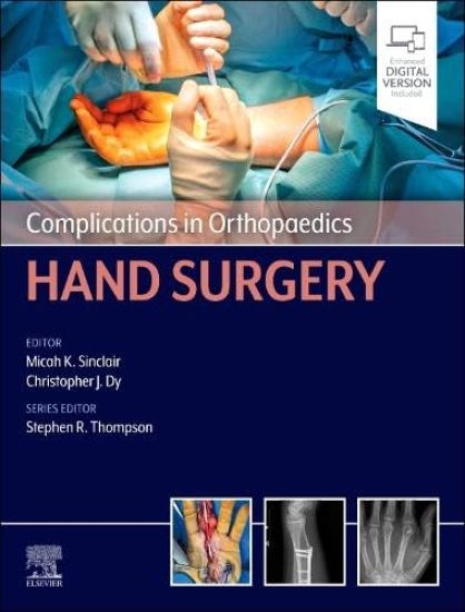 Complications in Orthopaedics: Hand Surgery