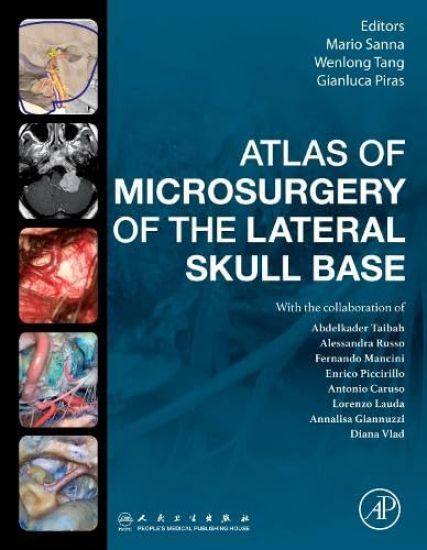 Atlas of Microsurgery of the Lateral Skull Base