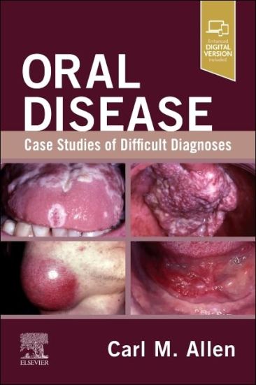 Oral Disease: Case Studies of Difficult Diagnoses