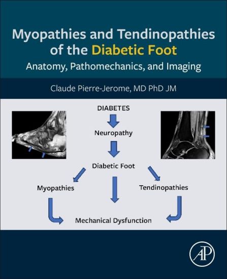 Myopathies and Tendinopathies of the Diabetic Foot