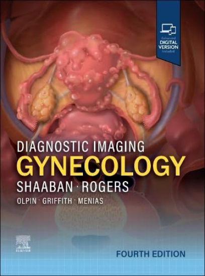 Diagnostic Imaging: Gynecology