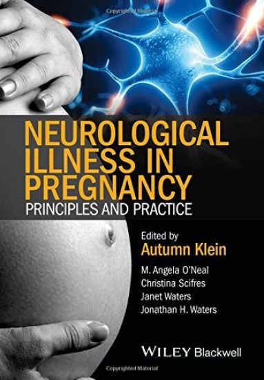Neurological Illness in Pregnancy