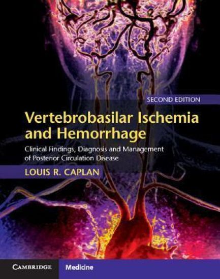 Vertebrobasilar Ischemia and Hemorrhage