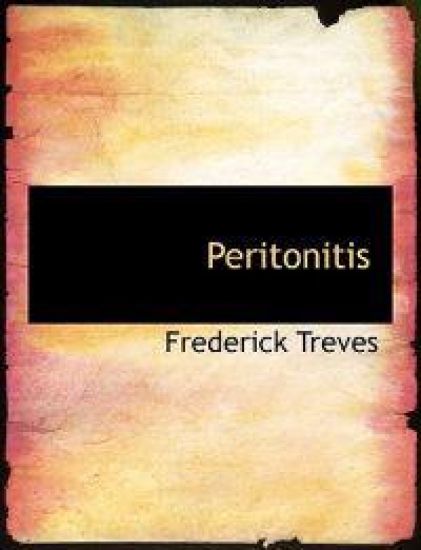 Peritonitis