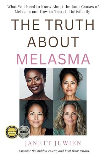The Truth About Melasma