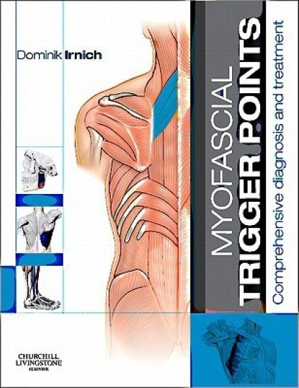 Myofascial Trigger Points