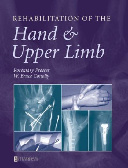 Rehabilitation of the Hand and Upper Limb