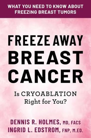 Freeze Away Breast Cancer: Is Cryoablation Right for You?