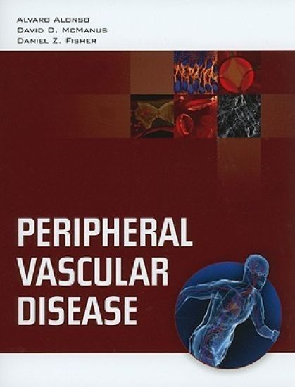 Peripheral Vascular Disease