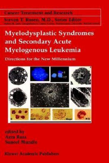 Myelodysplastic Syndromes & Secondary Acute Myelogenous Leukemia