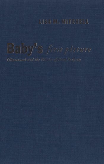 Baby's First Picture