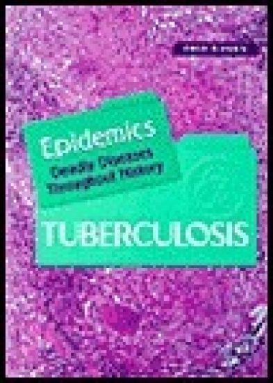 Tuberculosis