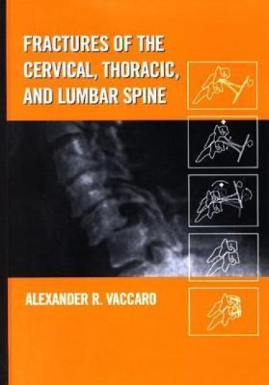 Fractures of the Cervical, Thoracic, and Lumbar Spine