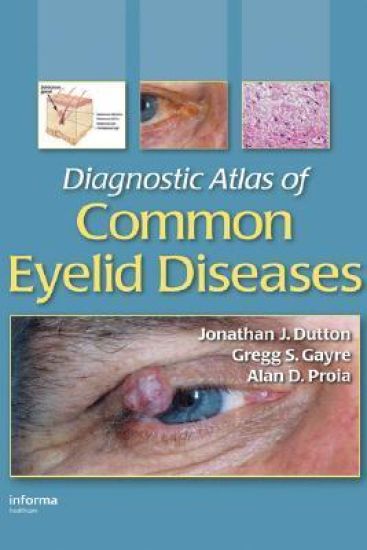 Diagnostic Atlas of Common Eyelid Diseases
