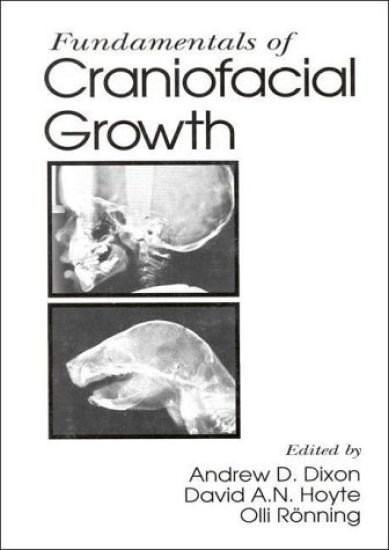 Fundamentals of Craniofacial Growth