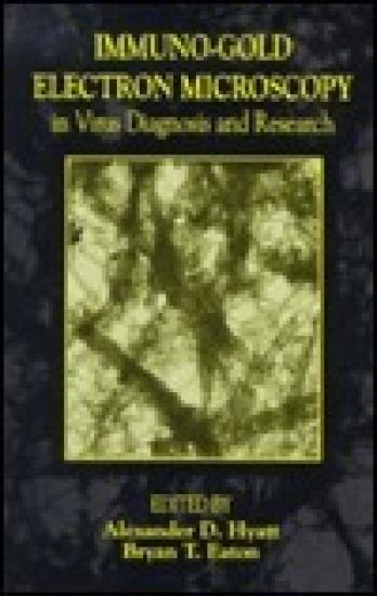 Immuno-Gold Electron Microscopy in Virus Diagnosis and Research