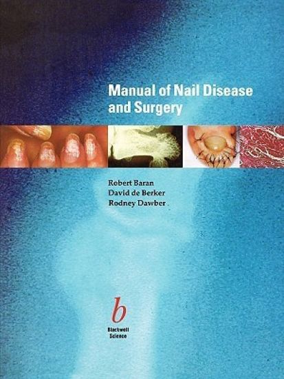 Manual of Nail Disease and Surgery
