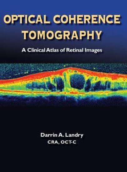 Optical Coherence Tomography