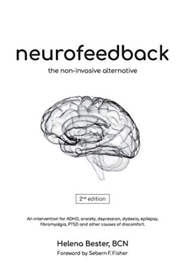 Neurofeedback