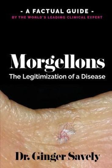 Morgellons: The legitimization of a disease: A Factual Guide by the World's Leading Clinical Expert