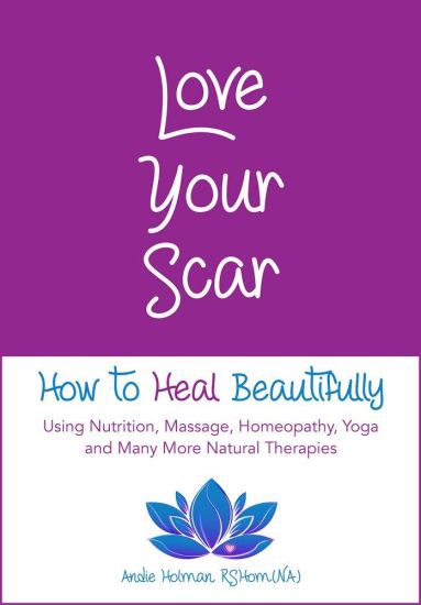 Love Your Scar: How to Heal Beautifully Using Nutrition, Massage, Homeopathy, Yoga and Many More Natural Therapies