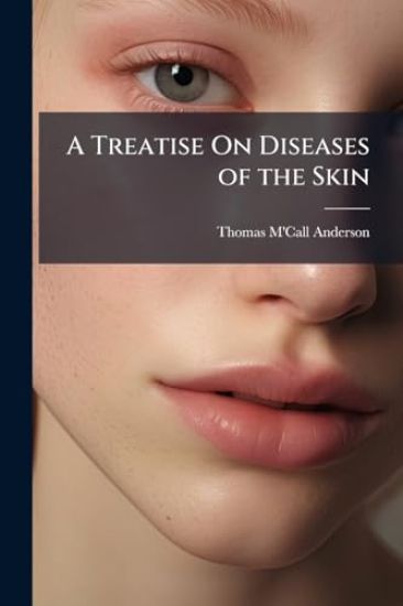 A Treatise On Diseases of the Skin