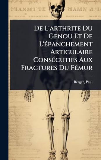 De L'arthrite Du Genou Et De L'Ã(c)panchement Articulaire ConsÃ(c)cutifs Aux Fractures Du FÃ(c)mur