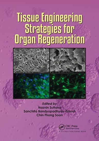 Tissue Engineering Strategies for Organ Regeneration