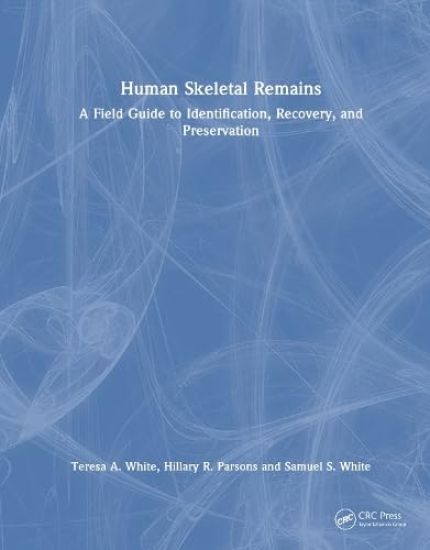 Human Skeletal Remains