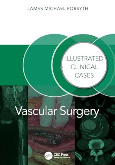 Vascular Surgery: