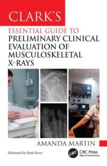 Clark’s Essential Guide to Preliminary Clinical Evaluation of Musculoskeletal X-rays