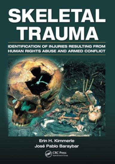 Skeletal Trauma