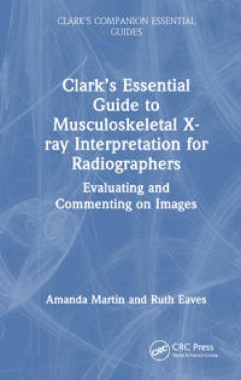 Clark’s Essential Guide to Preliminary Clinical Evaluation of Musculoskeletal X-rays